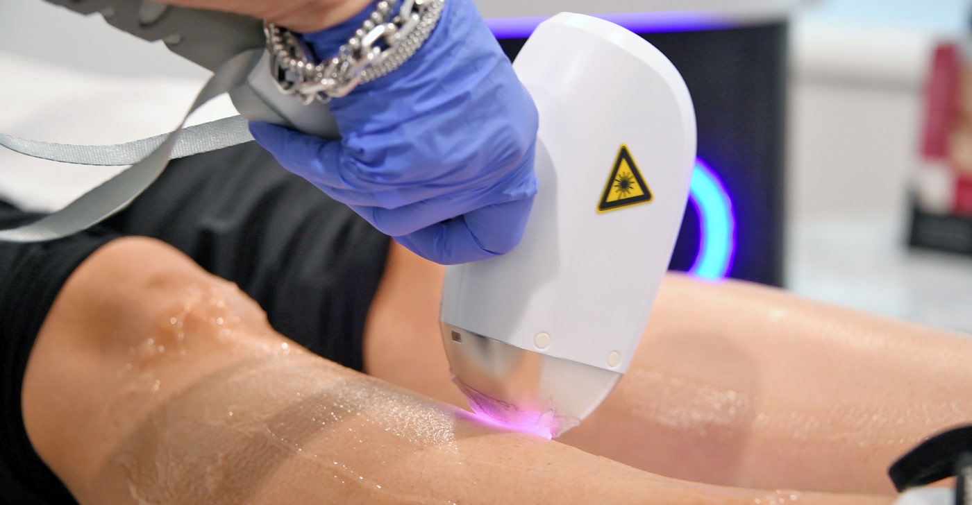 MediDiode Laser Hair Removal in 20 Minutes or Less