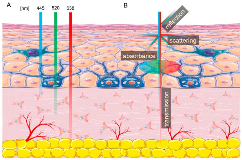 Aesthetic Lasers : A Comprehensive Guide